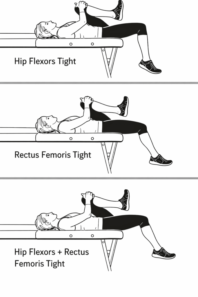 Thomas Test three common outcomes