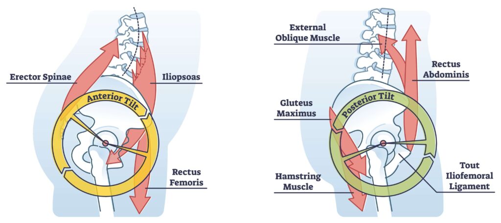 anterior pelvic tilt and posterior pelvic tilt